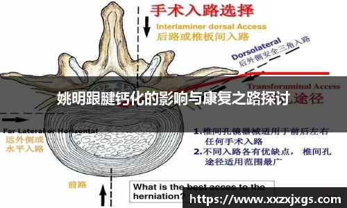 姚明跟腱钙化的影响与康复之路探讨